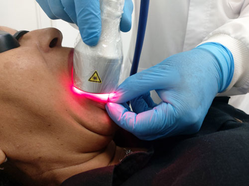 Curso de capacitação em terapia a laser para parar de fumar online