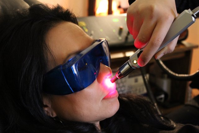 Aplicação de laser auricular para parar de fumar trabalhar com terapia a laser para tabagismo